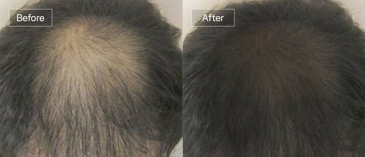 /filedata/md_board/20260102174529_NxXCSnU8_slide1.jpg 전후사진