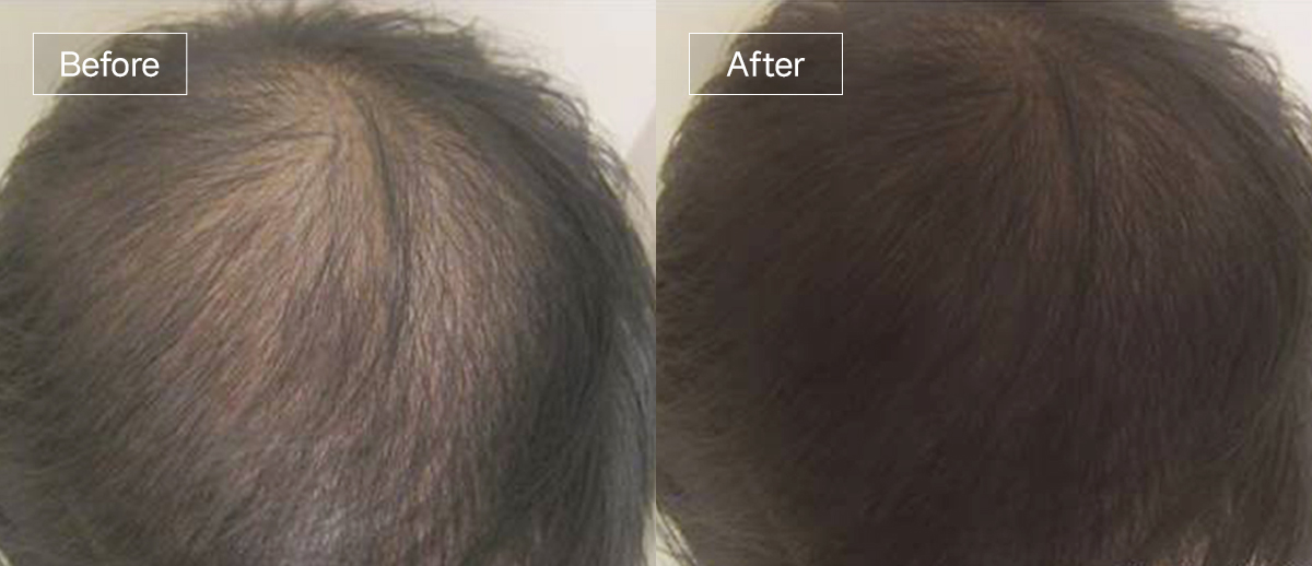 /filedata/md_board/20260102174549_QgMOpvhm_slide3.jpg 전후사진