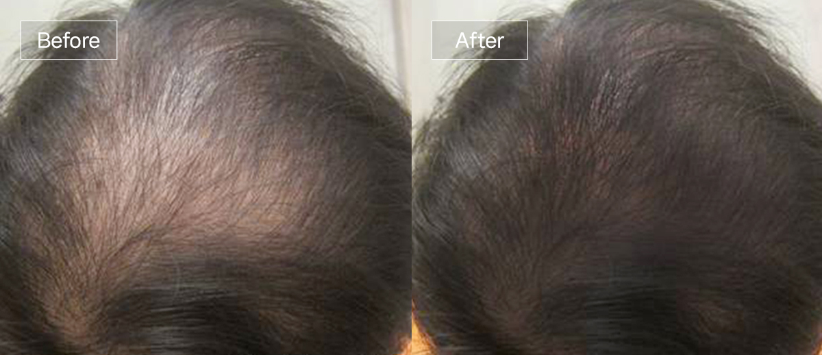 /filedata/md_board/20260102174605_1rG2E9CK_slide5.jpg 전후사진