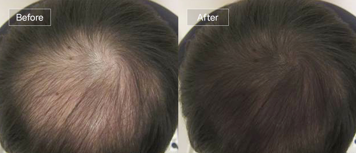 /filedata/md_board/20260102174613_9SOoGM7h_slide6.jpg 전후사진