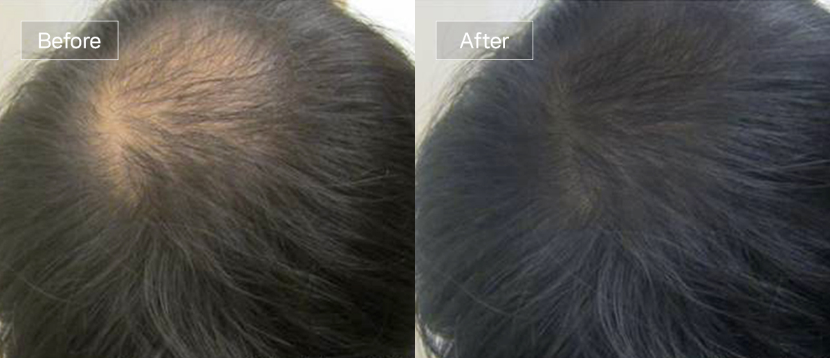 /filedata/md_board/20260102174709_OizYmNXs_slide8.jpg 전후사진