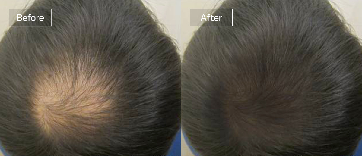 /filedata/md_board/20260102174829_Gw7b9NvU_slide10.jpg 전후사진