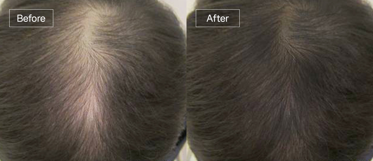 /filedata/md_board/20260102174932_eSrgny8t_slide13.jpg 전후사진