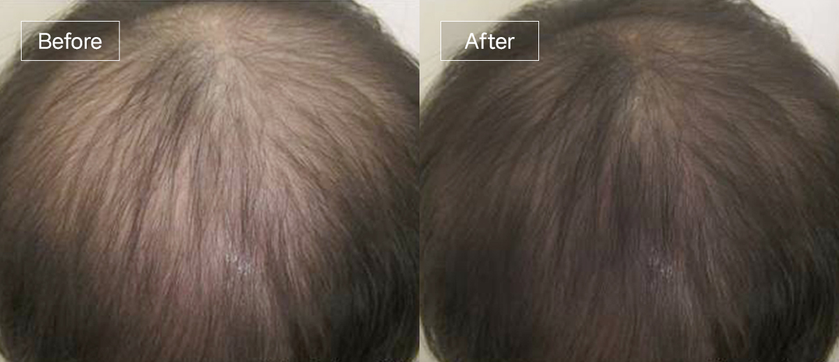 /filedata/md_board/20260102174950_DB0xqyEU_slide14.jpg 전후사진