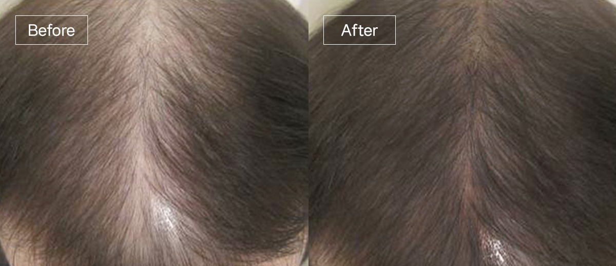 /filedata/md_board/20260102174959_GdAaTQ28_slide15.jpg 전후사진