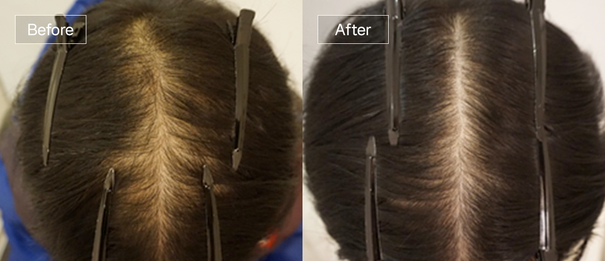 /filedata/md_board/20260102175156_P3DLqUi5_sub4_slide4.jpg 전후사진