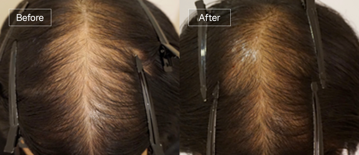 /filedata/md_board/20260102175218_kHueDhnG_sub4_slide6.jpg 전후사진