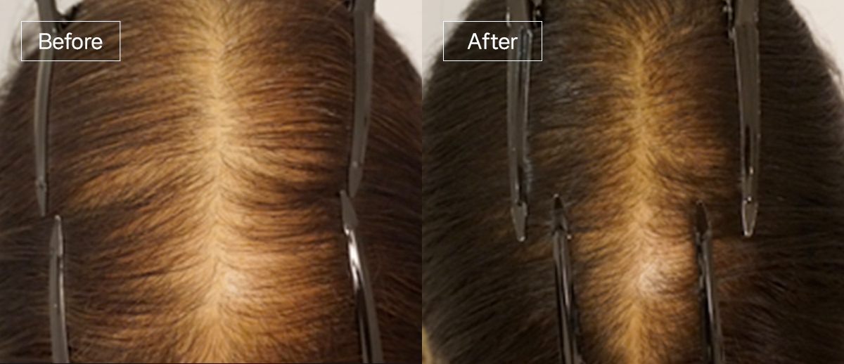 /filedata/md_board/20260102175254_FturBRbd_sub4_slide7.jpg 전후사진