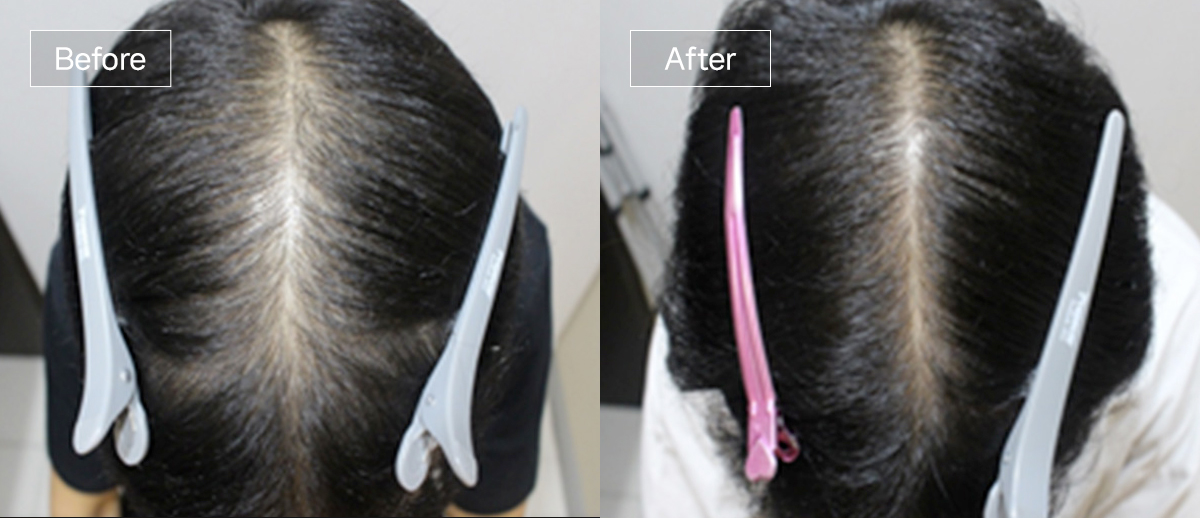 /filedata/md_board/20260102175302_4E0FZDig_sub4_slide8.jpg 전후사진