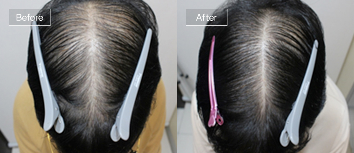 /filedata/md_board/20260102175309_ymnw1dMu_sub4_slide9.jpg 전후사진