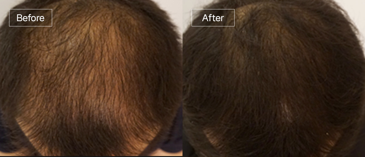 /filedata/md_board/20260102175316_Z4Fq26NP_sub4_slide10.jpg 전후사진